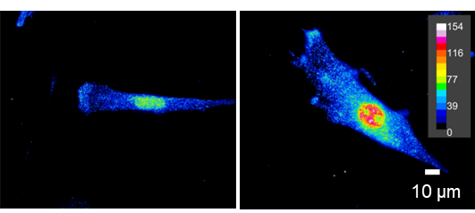fibrosis2